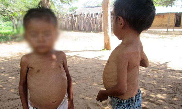 Colombia reports sharp rise in nutrition-related child deaths