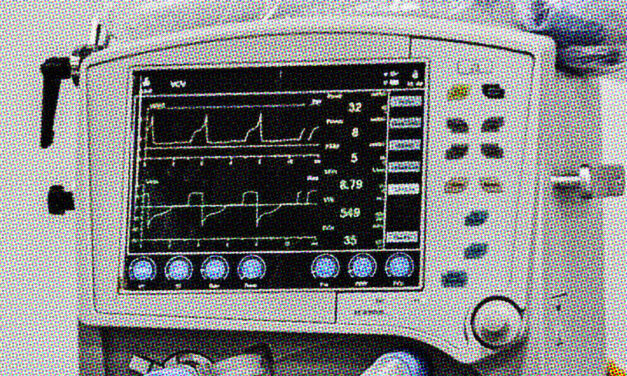 COVID-19: Colombia’s healthcare capacity and collapses